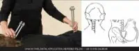 Ohm Octave Tuning Forks Cranial Sacral application